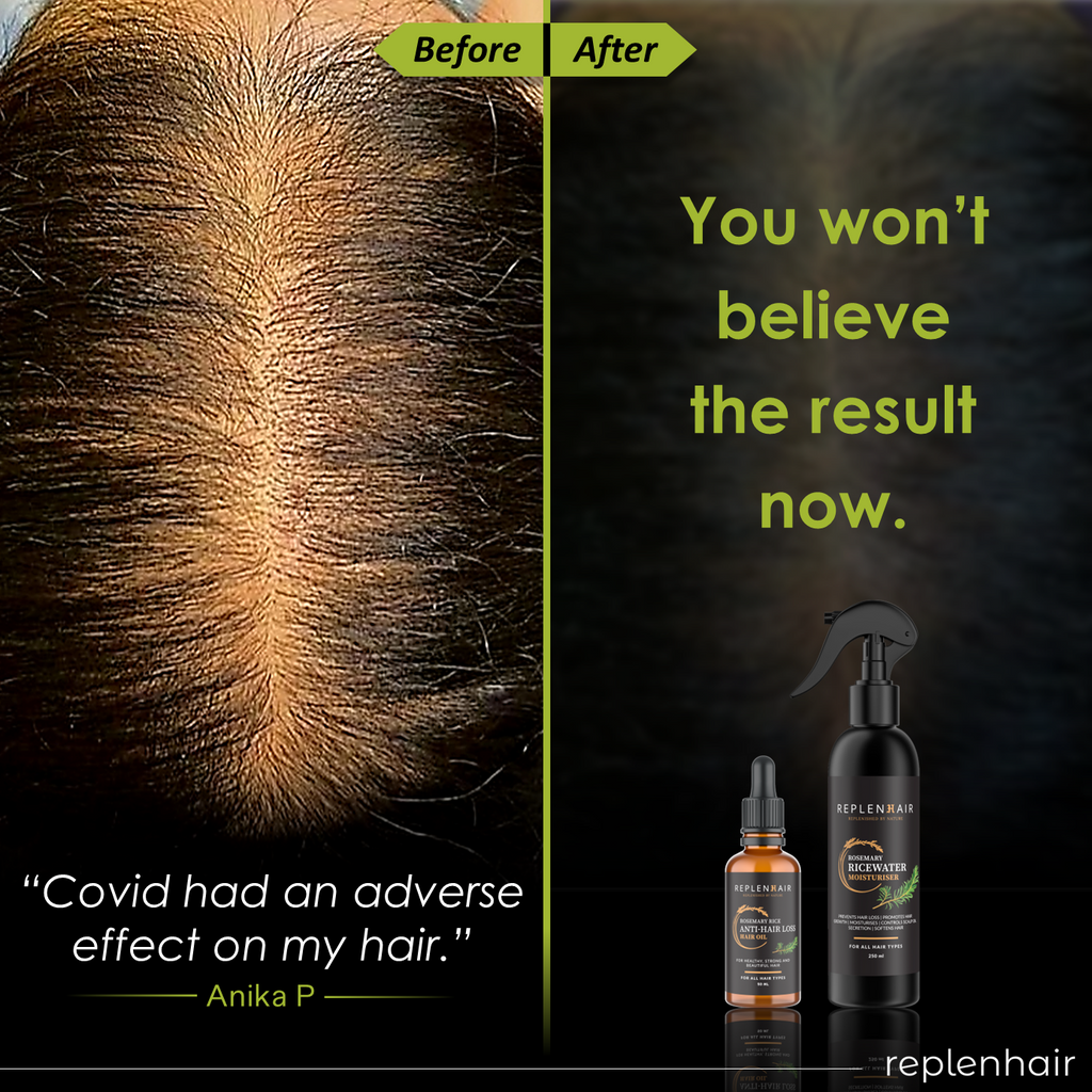Rosemary Rice Water Duo | Scalp Oil & Leave-In Spray