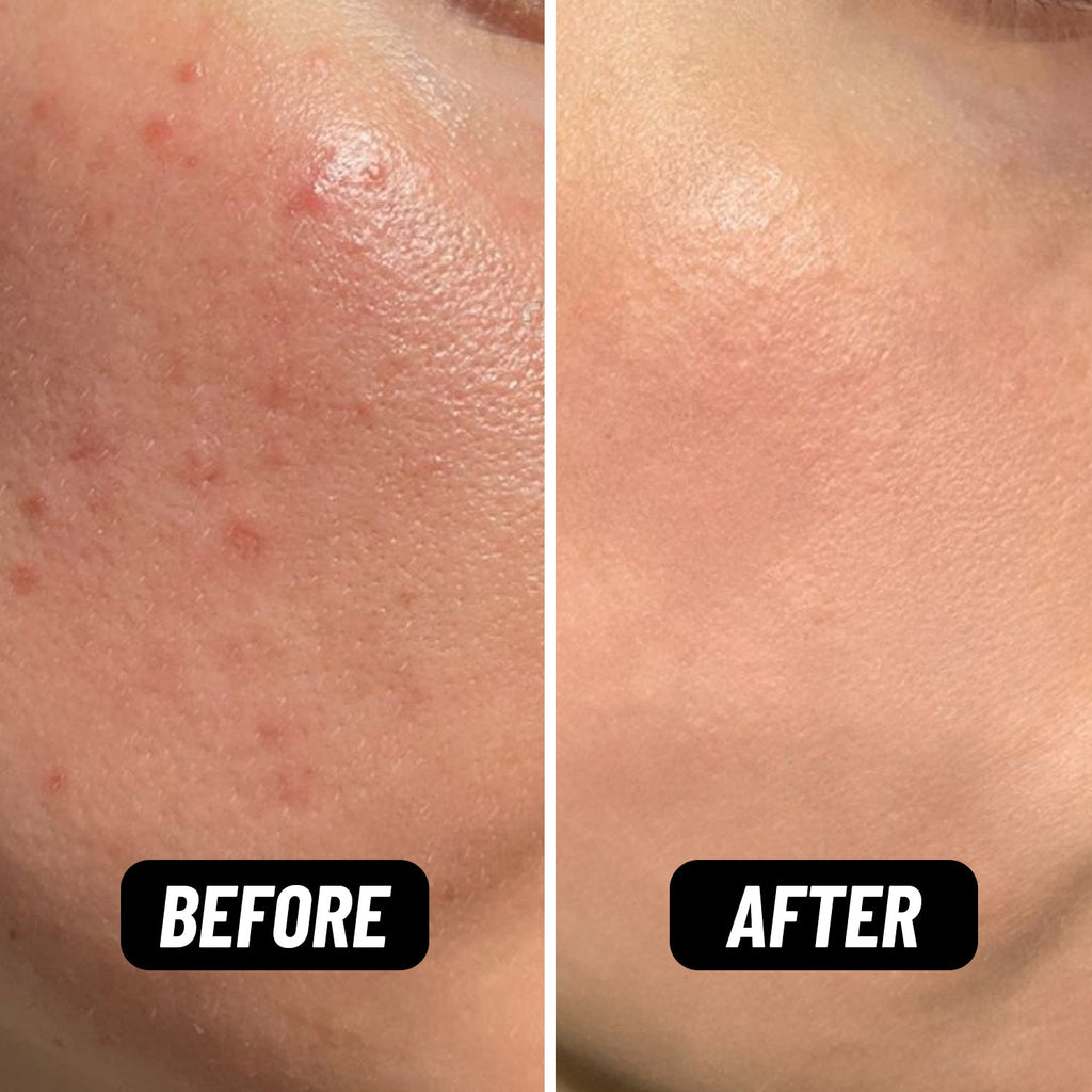 Bring Your Fire Facial Oil