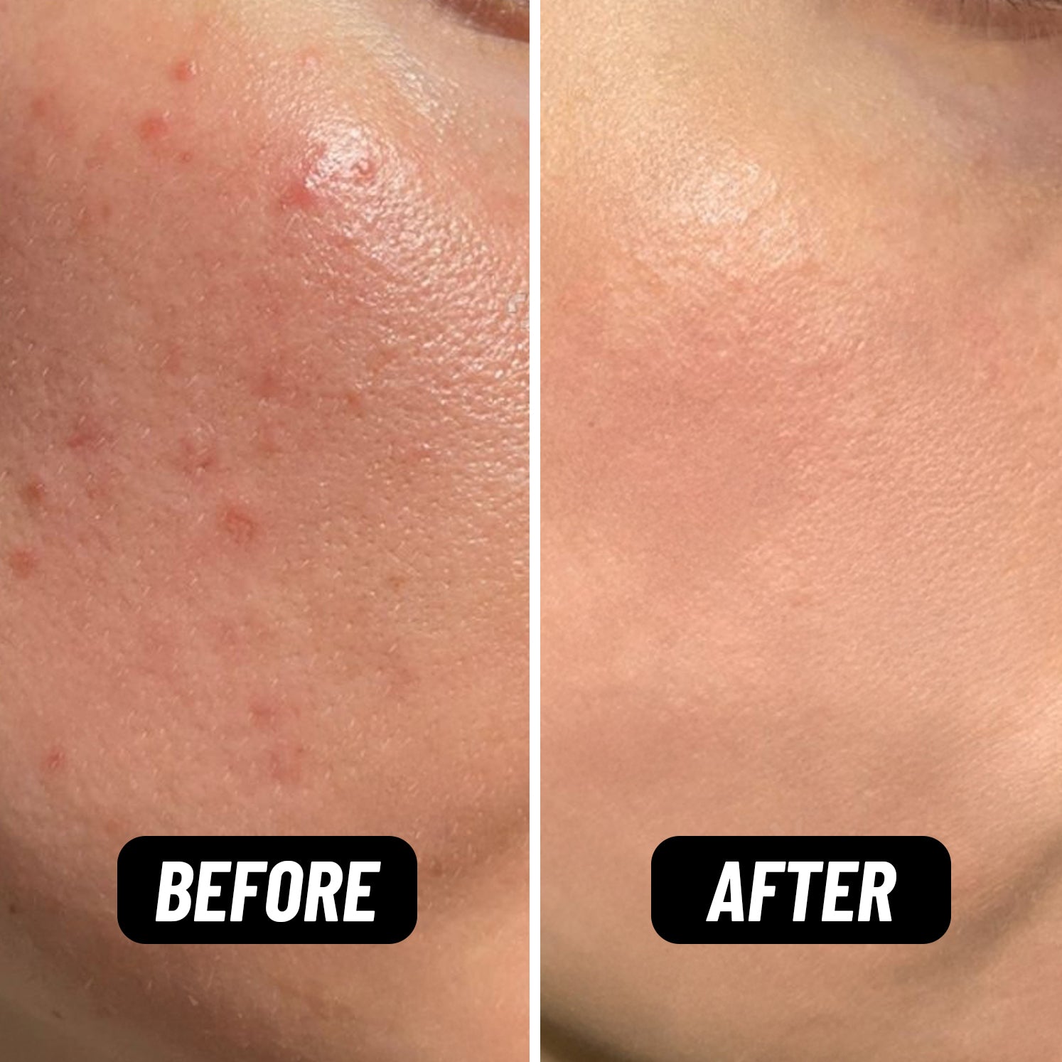 Bring Your Fire Facial Oil