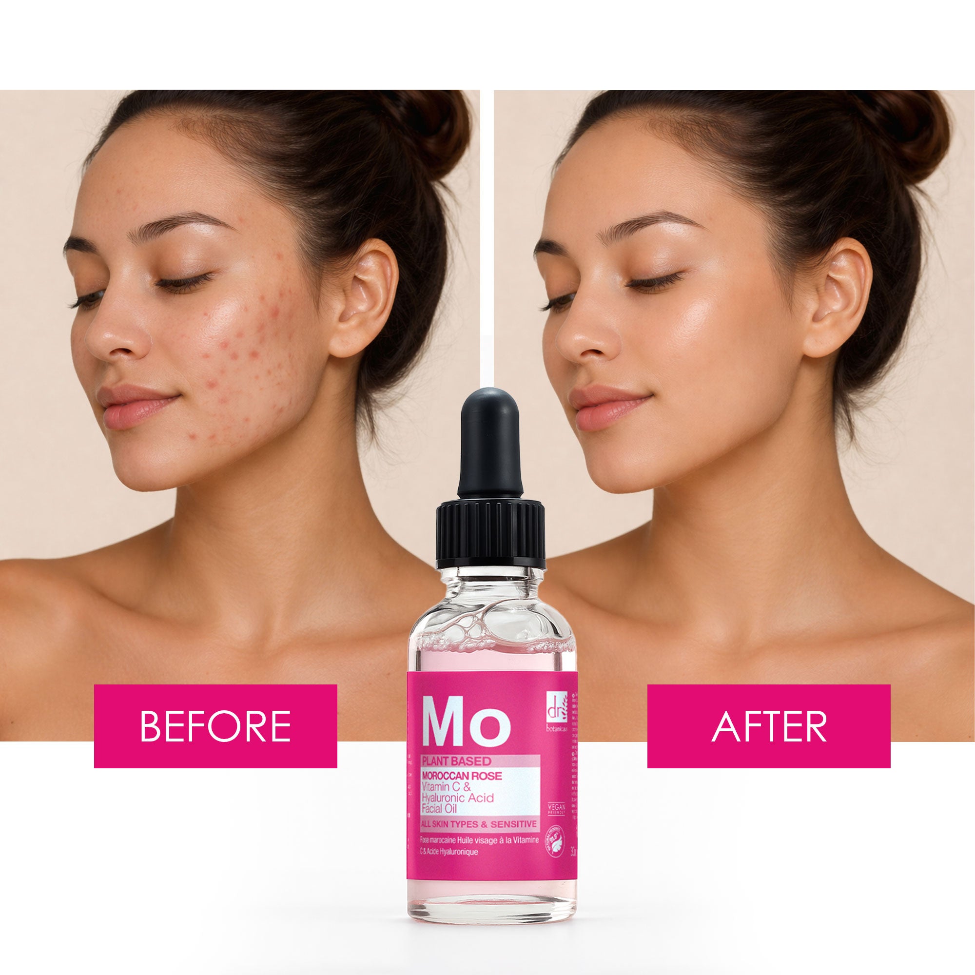 Moroccan Rose Facial Oil with Hyaluronic Acid & Vitamin C